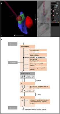 Reduced Programming Time and Strong Symptom Control Even in Chronic Course Through Imaging-Based DBS Programming